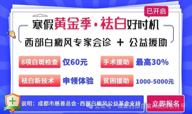 治白癜风成都哪个医院好