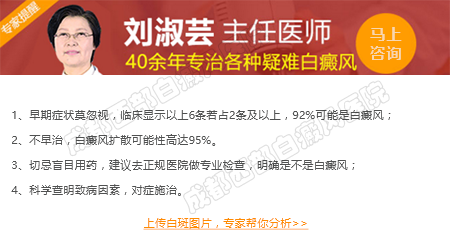成都的白癜风医院哪家好