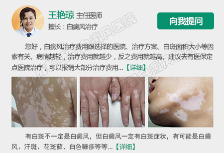 成都的白癜风医院哪家好