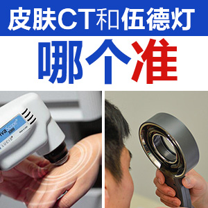 成都的白癜风医院哪家好