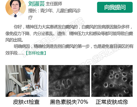 成都的白癜风医院哪家好